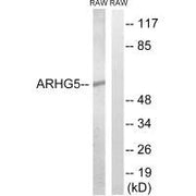 Western blot analysis of extracts from RAW264.7 cells, using ARHGEF5 antibody.