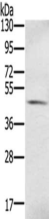 Gel: 8%SDS-PAGE, Lysate: 40 ug, Lane: Human fetal brain tissue, Primary antibody: CSB-PA125380(S100PBP Antibody) at dilution 1/350, Secondary antibody: Goat anti rabbit IgG at 1/8000 dilution, Exposure time: 1 minute