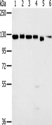 Gel: 6%SDS-PAGE, Lysate: 40 ug, Lane 1-6: 293T cells, K562 cells, hela cells, 231 cells, Jurkat cells, NIH/3T3 cells, Primary antibody: CSB-PA125471(MATR3 Antibody) at dilution 1/500, Secondary antibody: Goat anti rabbit IgG at 1/8000 dilution, Ex...