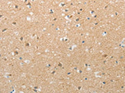 The image on the left is immunohistochemistry of paraffin-embedded Human brain tissue using CSB-PA125699(TACR2 Antibody) at dilution 1/20, on the right is treated with synthetic peptide. (Original magnification: ×200)