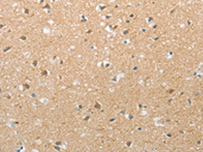 The image on the left is immunohistochemistry of paraffin-embedded Human brain tissue using CSB-PA125699(TACR2 Antibody) at dilution 1/20, on the right is treated with synthetic peptide. (Original magnification: ×200)