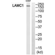 Western blot analysis of extracts from HUVEC cells, using MSH6 antibody.