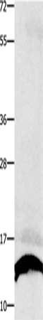 Gel: 10+12%SDS-PAGE, Lysate: 40 ug, Lane: Human liver cancer tissue, Primary antibody: CSB-PA126082(COX5B Antibody) at dilution 1/250, Secondary antibody: Goat anti rabbit IgG at 1/8000 dilution, Exposure time: 1 second