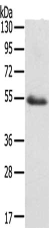 Gel: 8%SDS-PAGE, Lysate: 40 ug, Lane: Human kidney cancer tissue, Primary antibody: CSB-PA126136(EDIL3 Antibody) at dilution 1/250, Secondary antibody: Goat anti rabbit IgG at 1/8000 dilution, Exposure time: 2 minutes