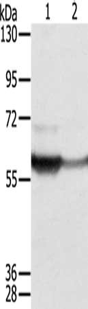 Gel: 8%SDS-PAGE, Lysate: 40 ug, Lane 1-2: Jurkat cells, mouse bladder tissue, Primary antibody: CSB-PA126140(CTSA Antibody) at dilution 1/250, Secondary antibody: Goat anti rabbit IgG at 1/8000 dilution, Exposure time: 10 seconds