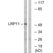 Western blot analysis of extracts from Jurkat cells, using LRP11 antibody.