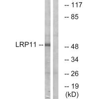 Western blot analysis of extracts from Jurkat cells, using LRP11 antibody.