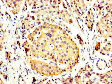 IHC image of CSB-PA12619A0Rb diluted at 1:400 and staining in paraffin-embedded human pancreatic tissue performed on a Leica BondTM system. After dewaxing and hydration, antigen retrieval was mediated by high pressure in a citrate buffer (pH 6.0)....