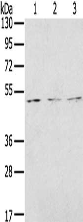 Gel: 8%SDS-PAGE, Lysate: 40 ug, Lane 1-3: Jurkat cells, K562 cells, 293T cells, Primary antibody: CSB-PA126339(FOXG1 Antibody) at dilution 1/200, Secondary antibody: Goat anti rabbit IgG at 1/8000 dilution, Exposure time: 5 minutes