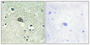 Immunohistochemical analysis of paraffin-embedded human brain tissue using NMDAR1 (Phospho-Ser890) antibody (left)or the same antibody preincubated with blocking peptide (right).