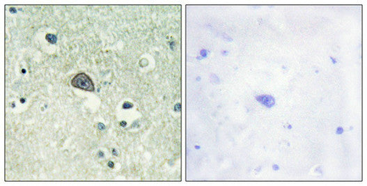 Immunohistochemical analysis of paraffin-embedded human brain tissue using NMDAR1 (Phospho-Ser890) antibody (left)or the same antibody preincubated with blocking peptide (right).