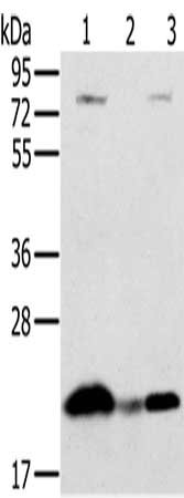 Gel: 10%SDS-PAGE, Lysate: 40 ug, Lane 1-3: Raji cells, human liver cancer tissue, hela cells, Primary antibody: CSB-PA126729(NDUFAF2 Antibody) at dilution 1/250, Secondary antibody: Goat anti rabbit IgG at 1/8000 dilution, Exposure time: 10 seconds