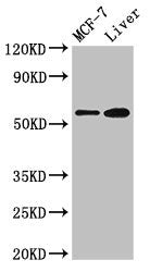 Western Blot Positive WB detected in: MCF-7 whole cell lysate, Mouse liver tissue All lanes: CBS antibody at 2.7µg/ml Secondary Goat polyclonal to rabbit IgG at 1/50000 dilution Predicted band size: 61, 62 kDa Observed band size: 61 kDa