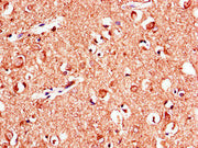 Immunohistochemistry of paraffin-embedded human brain tissue using CSB-PA12729A0Rb at dilution of 1:100
