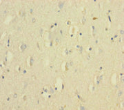 Immunohistochemistry of paraffin-embedded human brain tissue using CSB-PA12779A0Rb at dilution of 1:100