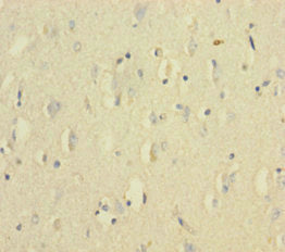 Immunohistochemistry of paraffin-embedded human brain tissue using CSB-PA12779A0Rb at dilution of 1:100