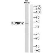 Western blot analysis of extracts from Rat Muscle cells, using KCNK12 antibody.