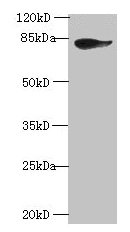 Western blot All lanes: JUP antibody at 2µg/ml + A431 whole cell lysate Secondary Goat polyclonal to rabbit IgG at 1/10000 dilution Predicted band size: 82 kDa Observed band size: 82 kDa