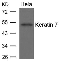 Western blot analysis of extracts from Hela cells using Keratin 7 Antibody.
