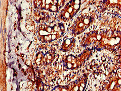 Immunohistochemistry of paraffin-embedded human small intestine tissue using CSB-PA12869A0Rb at dilution of 1:100