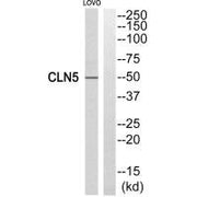 Western blot analysis of extracts from LOVO cells, using CLN5 antibody.