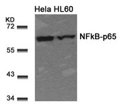 Western blot analysis of extracts from Hela and HL60 cells using NFkB-p65(Ab-311) Antibody.