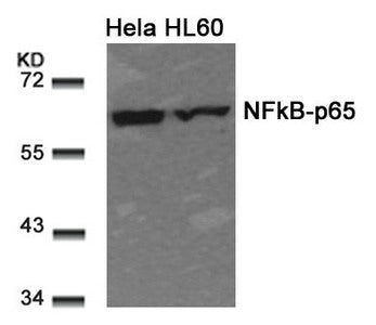 Western blot analysis of extracts from Hela and HL60 cells using NFkB-p65(Ab-311) Antibody.