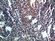 Immunohistochemical analysis of paraffin-embedded Human-tonsil, antibody was diluted at 1:100