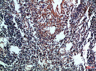 Immunohistochemical analysis of paraffin-embedded Human-tonsil, antibody was diluted at 1:100