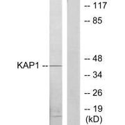 Western blot analysis of extracts from COLO205 cells, using KAP1 antibody.