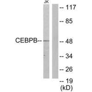 Western blot analysis of extracts from Jurkat cells, using CEBPB antibody.