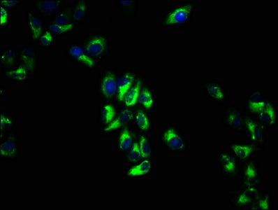 Immunofluorescence staining of Hela cells with CSB-PA13005A0Rb at 1:66, counter-stained with DAPI. The cells were fixed in 4% formaldehyde, permeabilized using 0.2% Triton X-100 and blocked in 10% normal Goat Serum. The cells were then incubated w...