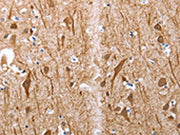 The image on the left is immunohistochemistry of paraffin-embedded Human brain tissue using CSB-PA130852(Map2 Antibody) at dilution 1/25, on the right is treated with synthetic peptide. (Original magnification: ×200)
