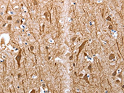 The image on the left is immunohistochemistry of paraffin-embedded Human brain tissue using CSB-PA130852(Map2 Antibody) at dilution 1/25, on the right is treated with synthetic peptide. (Original magnification: ×200)