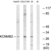 Western blot analysis of extracts from HepG2 cells, COLO cells and Jurkat cells, using KCNMB2 antibody.