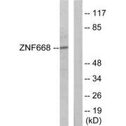 Western blot analysis of extracts from Jurkat cells, using ZNF668 antibody.