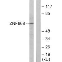 Western blot analysis of extracts from Jurkat cells, using ZNF668 antibody.