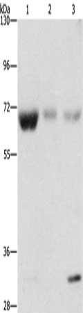 Gel: 8%SDS-PAGE, Lysate: 40 ug, Lane 1-3: Human fetal muscle tissue, Human kidney tissue, Human liver tissue, Primary antibody: CSB-PA131191(NAE1 Antibody) at dilution 1/500, Secondary antibody: Goat anti rabbit IgG at 1/8000 dilution, Exposure ti...