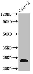Western Blot Positive WB detected in: Caco-2 whole cell lysate All lanes: CLDN3 antibody at 3.5µg/ml Secondary Goat polyclonal to rabbit IgG at 1/50000 dilution Predicted band size: 24 kDa Observed band size: 24 kDa