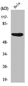 Western Blot analysis of HeLa cells using AMPKα1 Polyclonal Antibody