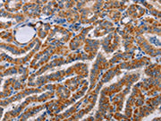 The image on the left is immunohistochemistry of paraffin-embedded Human brain tissue using CSB-PA131441(ALG9 Antibody) at dilution 1/60, on the right is treated with fusion protein. (Original magnification: ×200)