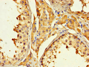 Immunohistochemistry of paraffin-embedded human testis tissue using CSB-PA13219A0Rb at dilution of 1:100