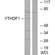 Western blot analysis of extracts from 293 cells, using YTHDF1 antibody.