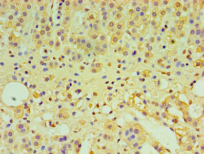 Immunohistochemistry of paraffin-embedded human adrenal gland tissue using CSB-PA13249A0Rb at dilution of 1:100