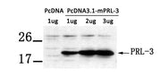 Western blot analysis of extract from LX-2 cells transfected with PRL-3 using PRL-3 antibody.