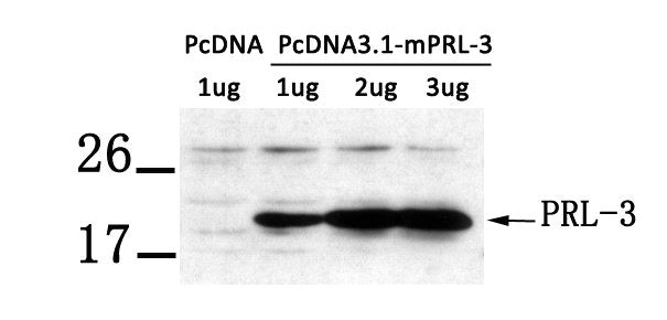 Western blot analysis of extract from LX-2 cells transfected with PRL-3 using PRL-3 antibody.