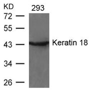 Western blot analysis of extracts from 293 cells using Keratin 18(Ab-33) Antibody.