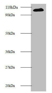 Western blot All lanes: MIB1 antibody at 2µg/ml + 293T whole cell lysate Secondary Goat polyclonal to rabbit IgG at 1/10000 dilution Predicted band size: 111 kDa Observed band size: 111 kDa