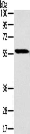 Gel: 8%SDS-PAGE, Lysate: 40 ug, Lane: 293T cells, Primary antibody: CSB-PA132903(SLC29A4 Antibody) at dilution 1/250, Secondary antibody: Goat anti rabbit IgG at 1/8000 dilution, Exposure time: 5 seconds