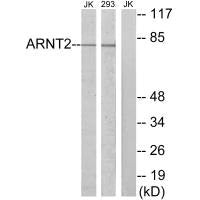 Western blot analysis of extracts from Jurkat cells and 293 cells, using ARNT2 antibody.